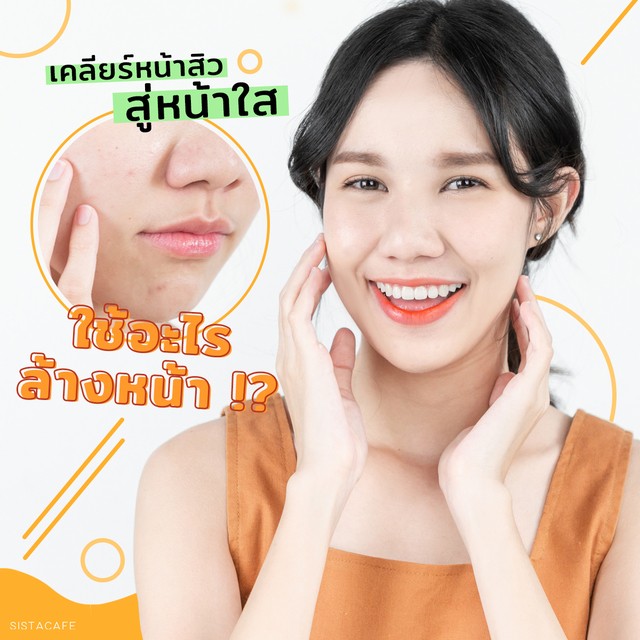 เป็นสิวต้องเริ่มจากการล้างหน้า เพื่อช่วยลดสิวได้ตั้งแต่ครั้งแรก