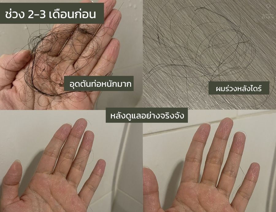 1628133258 anti hair loss review13