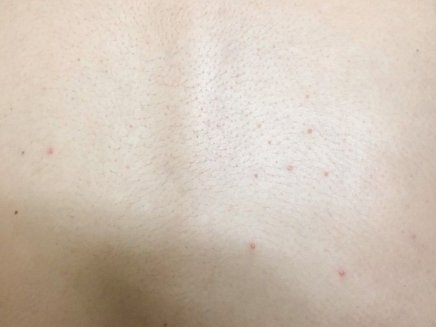 1636107380 img 7423