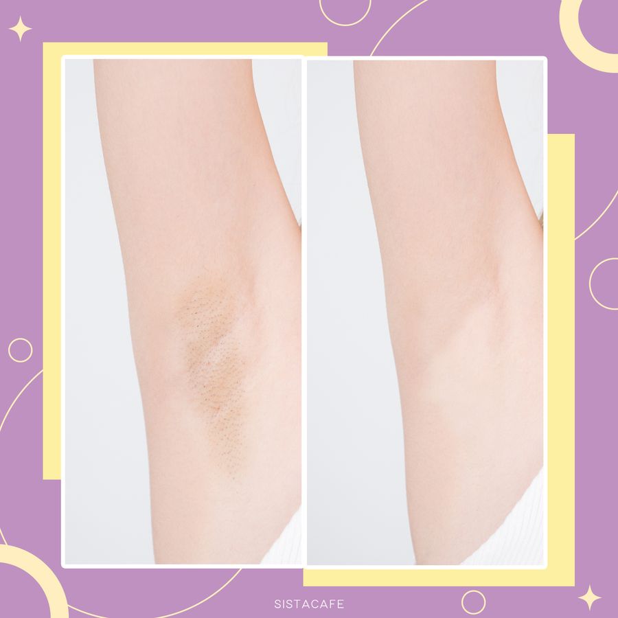รีวิวครีมทารักแร้ขาว สูตรเพื่อผิวกระจ่างใสพร้อมระงับกลิ่นกาย