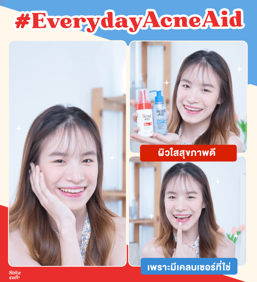 รีวิวโฟมล้างหน้าแอคเน่เอด สูตรใหม่สำหรับคนเป็นสิวเห่อจากผิวมันและผิวแพ้ง่าย