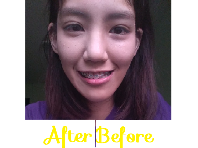 1459266770 before after beauty cottage