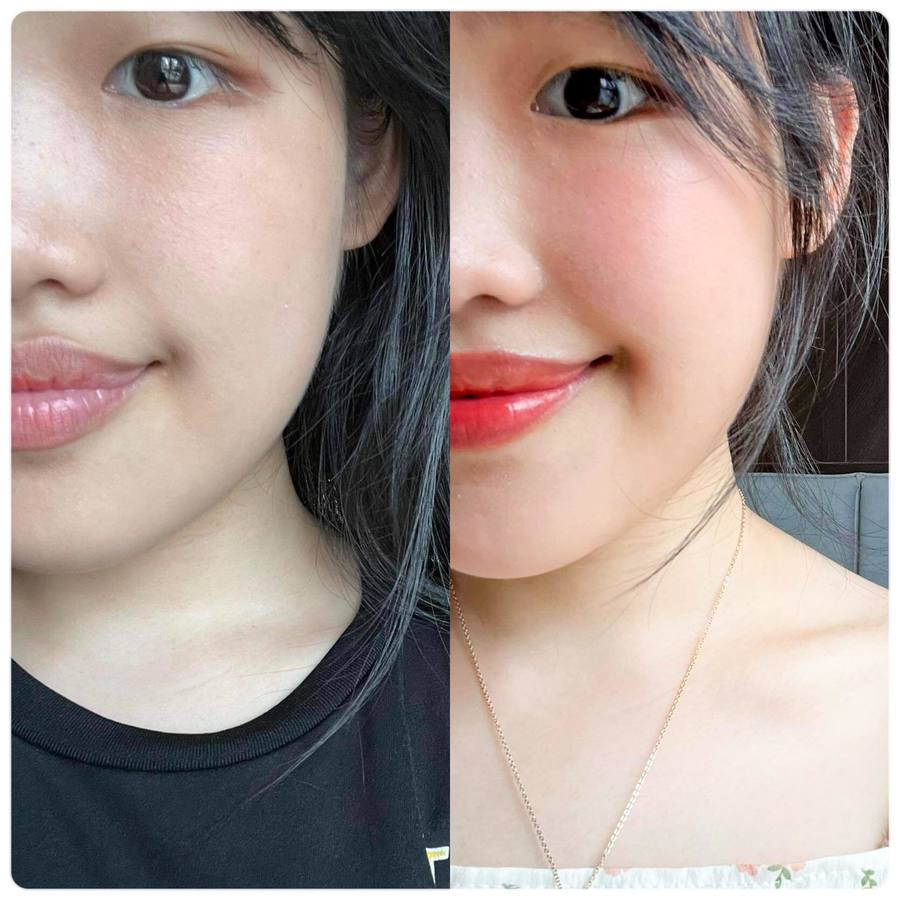 ผลลัพธ์Vida Vit C from Acerola cherry and Camu Camu