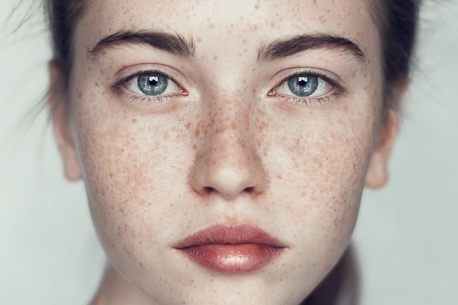 1698633596 girl with freckles shutterstock 102716