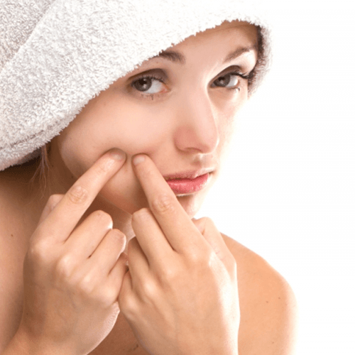 https://image.sistacafe.com/images/uploads/content_image/image/141830/1465196850-how-to-get-rid-of-pimples-quick.png