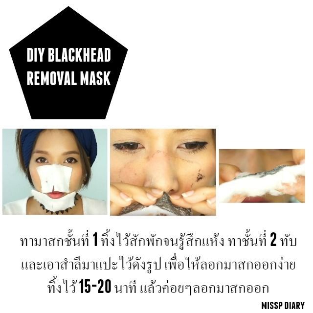 วิธีลอกมาส์กกำจัดสิวเสี้ยน