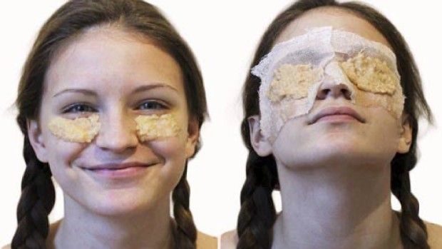 https://image.sistacafe.com/images/uploads/content_image/image/171164/1470043901-potato-dark-eyes-remedie.jpg
