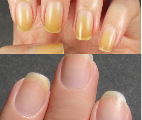 1479378103 how to whiten your nails