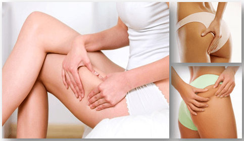1490260178 home remedies to get rid of cellulite on thighs