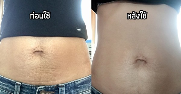1496393445 beforeafter000srta