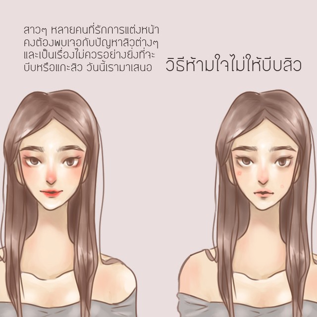 1501154593 1 v2