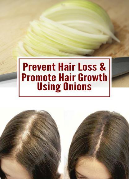 1502642108 prevent hair loss promote growth using onions