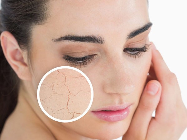 1509440023 dry skin 2