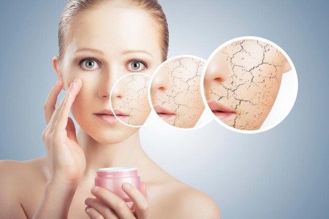 1510669323 5 tips to combat winter dry skin