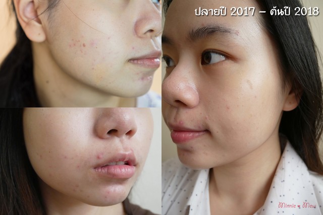1524545302 skincare routine minniemew 18