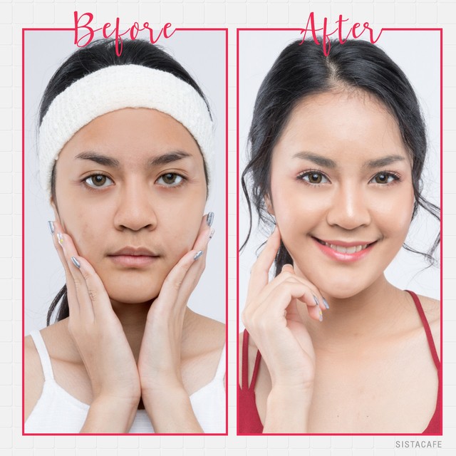 รีวิว ก่อนใช้ และหลังใช้ EUCERIN UltraSENSITIVE Q10X DAY CREAM ครีมสำหรับผิวแพ้ง่าย