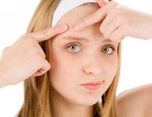 1450092207 acne 500x384