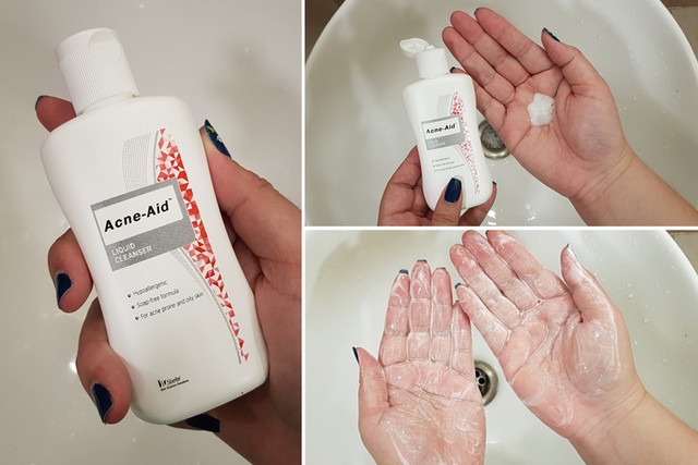 1533788709 acne aid