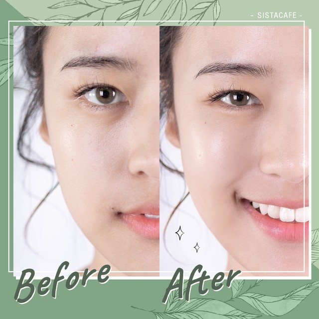 รีวิว Before & After ครีมรกแกะออสเตเลีย Joliena plus ครีมเข้มข้น แต่เนื้อบางเบา ทาปุ๊ปซึมปั๊ปทันที ผิวสวย GLow หน้าเด้ง หน้าเด็ก จนคนทัก