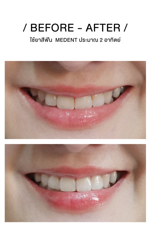 1545207508 bf at