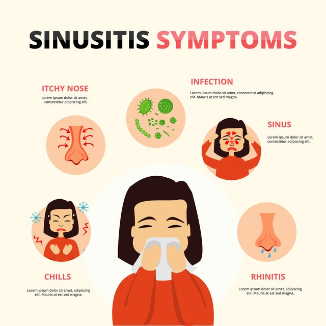 1555481585 sinusitis vector cartoon infographic
