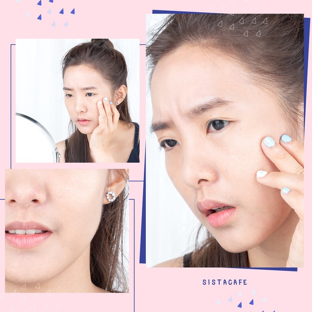 ผิวแห้งลอก ผิวแห้งทำไงดี ? ล้างหน้าด้วยโฟมล้างหน้า แต่ทำไมยิ่งพัง?