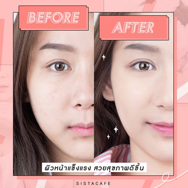 เซรั่มบำรุงผิวหน้า, เซรั่มมาสก์, กู้ผิว, ผิวแพ้ง่าย, ผิวหน้าแห้ง, เซรั่ม ลดริ้วรอย, เซรั่ม ก่อนแต่งหน้า, Sleeping Mask, เซรั่ม ญี่ปุ่น
