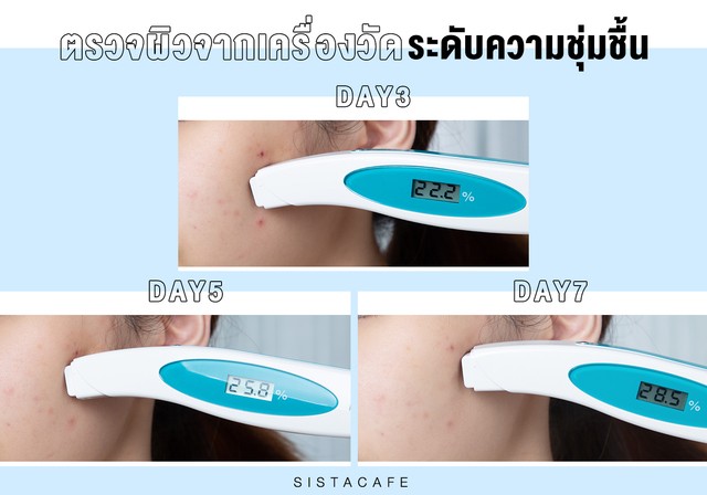 ผิวแพ้ง่าย_วัดความชุ่มชื้น_Curel Intensive Moisture Care Moisture Cream_ครีมเซราไมด์_คิวเรล