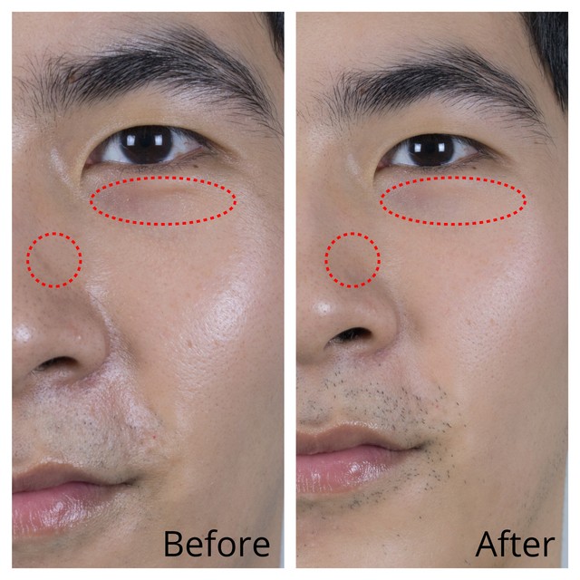 1571450748 juv before after jpg