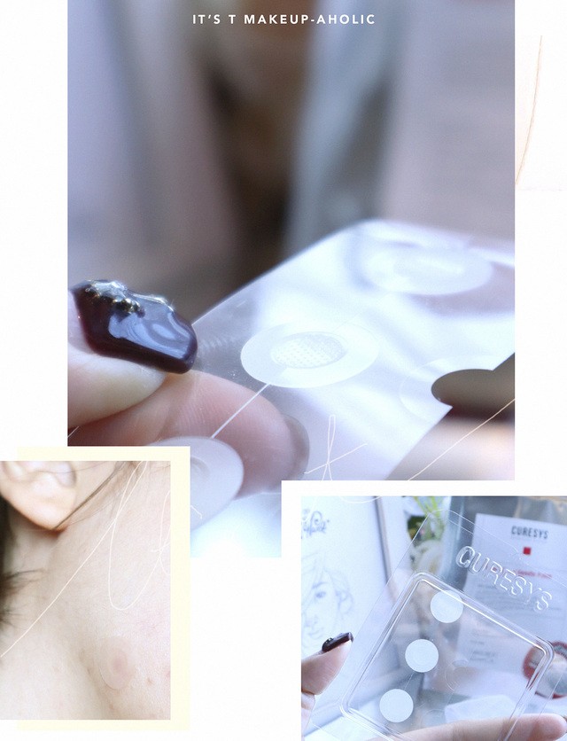 1580802107 itst makeupaholic rv curesys trouble clear 09 needle patch