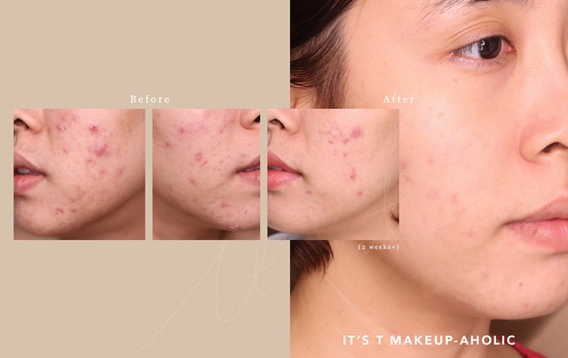 fyne bha clarifying serum