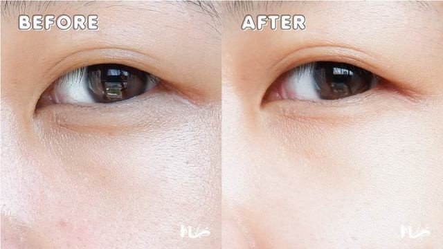 1590923975 theformulaeyeserum 14