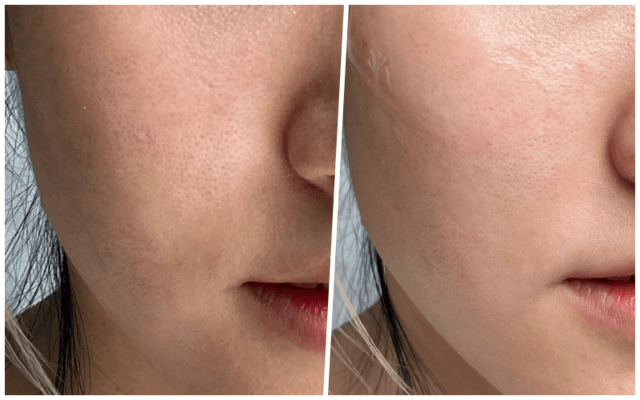 1596806018 collage serum face copy