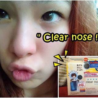 Review มาส์กดำขจัดสิวเสี้ยนง่ายๆ 3 step จาก Clear nose