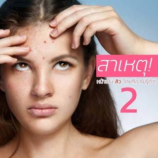 รู้กันหรือยัง? 12 สาเหตุที่ทำให้หน้าเป็นสิวโดยที่เราไม่รู้ตัว (2)