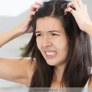 1542620815 itchy scalp treatments