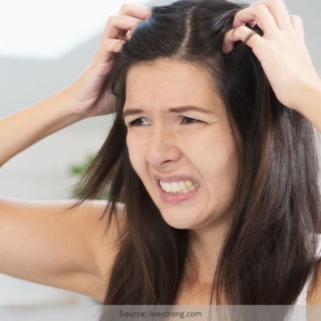 Itchy scalp treatments