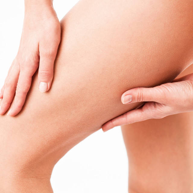1438925470 cellulitis