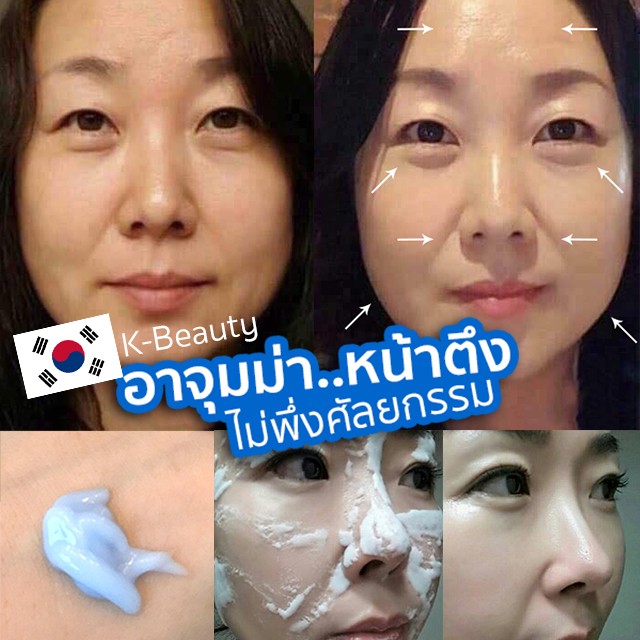 640x640cover blog ajumma nobotox