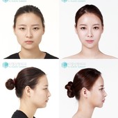 Icon korean plastic surgery before and after celebrity szzgl23w4