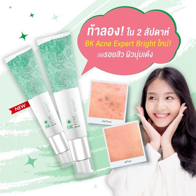 ท้าลองใน2สัปดาห์BKAcneExpertBrightใหม่ลดรอยสิวผิวนุ่มเด้ง