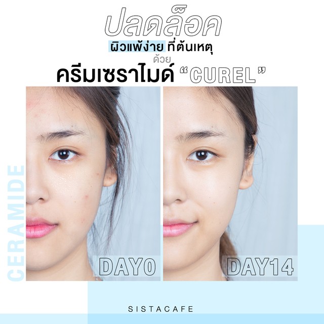 เซราไมด์_ครีมเซราไมด์_Curel_ผิวแพ้ง่าย