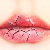Icon cracked and dry lips