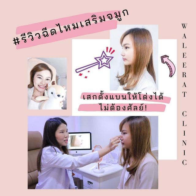 รีวิวฉีดไหมเสริมจมูก